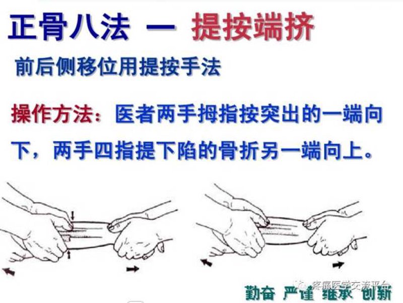 正骨复位：传统疗法与现代医疗的完美结合