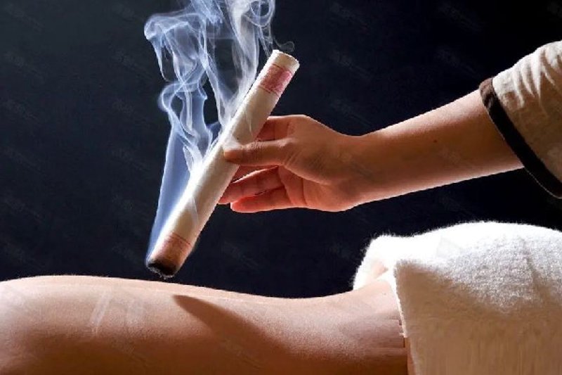 针灸推拿：千年传统焕发新活力